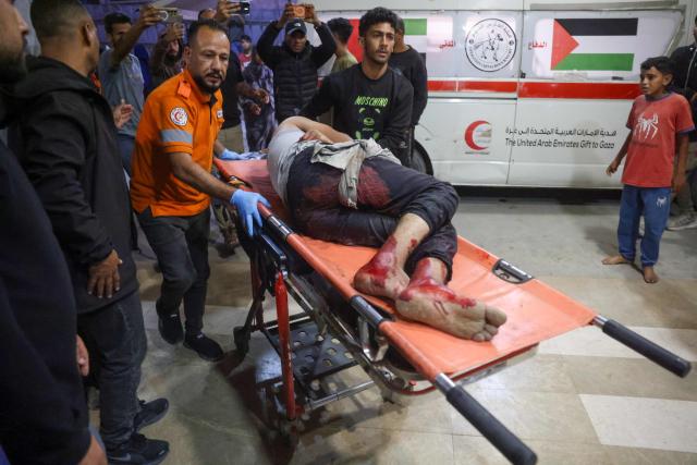 EDITORS NOTE: Graphic content / mergency responders bring an injured Palestinian on a stretcher into Nasser Hospital following an Israeli strike in Khan Yunis in the southern Gaza Strip on June 5, 2026. Despite a truce technically in effect since October 2025, daily violence has rocked the Gaza Strip, over half of which is under Israeli military control in defiance of the ceasefire's terms. Israel has killed at least 936 people since the ceasefire began, according to Gaza's health ministry, which operates under Hamas authority and whose figures are considered reliable by the UN. (Photo by Bashar Taleb / AFP)