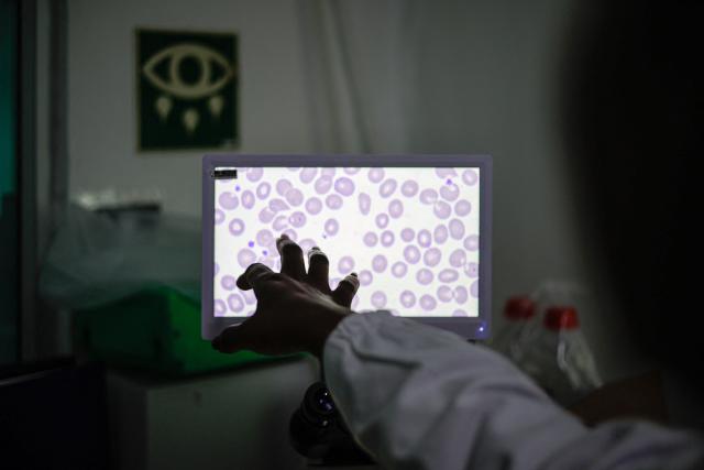 Medical technologist and laboratory manager at the National Health Laboratory Service Rirhandzu Mashale points to a malaria-positive blood sample projected from a microscope at Tintswalo Hospital in Bushbuckridge on May 26, 2026. Human-induced climate change, compounded by the La Nina weather pattern, has intensified extreme rainfall across southern Africa, the National Institute for Communicable Diseases (NICD) said, creating conditions that can fuel malaria transmission long after floodwaters recede.
In Mpumalanga, cases rose fourfold in January compared with a year earlier, jeopardising South Africa's goal of eliminating malaria by 2029. (Photo by EMMANUEL CROSET / AFP)