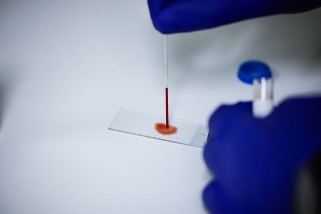 Medical technologist and laboratory manager at the National Health Laboratory Service Rirhandzu Mashale places a drop of blood on a slide before having it examined for malaria at Tintswalo Hospital in Bushbuckridge on May 26, 2026. Human-induced climate change, compounded by the La Nina weather pattern, has intensified extreme rainfall across southern Africa, the National Institute for Communicable Diseases (NICD) said, creating conditions that can fuel malaria transmission long after floodwaters recede.
In Mpumalanga, cases rose fourfold in January compared with a year earlier, jeopardising South Africa's goal of eliminating malaria by 2029. (Photo by EMMANUEL CROSET / AFP)