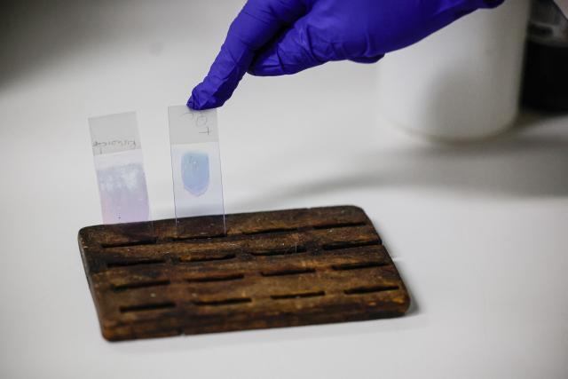 Medical technologist and laboratory manager at the National Health Laboratory Service Rirhandzu Mashale points to blood smear slide before having it examined for malaria at Tintswalo Hospital in Bushbuckridge on May 26, 2026. Human-induced climate change, compounded by the La Nina weather pattern, has intensified extreme rainfall across southern Africa, the National Institute for Communicable Diseases (NICD) said, creating conditions that can fuel malaria transmission long after floodwaters recede.
In Mpumalanga, cases rose fourfold in January compared with a year earlier, jeopardising South Africa's goal of eliminating malaria by 2029. (Photo by EMMANUEL CROSET / AFP)