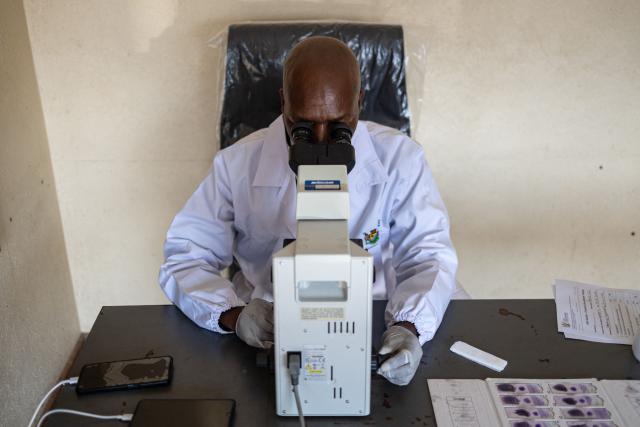 Microscopist Amrstrong Mgiba looks through a microscope as he analyses a blood sample for Malaria at the Cunningmore Clinic in Bushbuckridge on May 26, 2026. Human-induced climate change, compounded by the La Nina weather pattern, has intensified extreme rainfall across southern Africa, the National Institute for Communicable Diseases (NICD) said, creating conditions that can fuel malaria transmission long after floodwaters recede.
In Mpumalanga, cases rose fourfold in January compared with a year earlier, jeopardising South Africa's goal of eliminating malaria by 2029. (Photo by EMMANUEL CROSET / AFP)