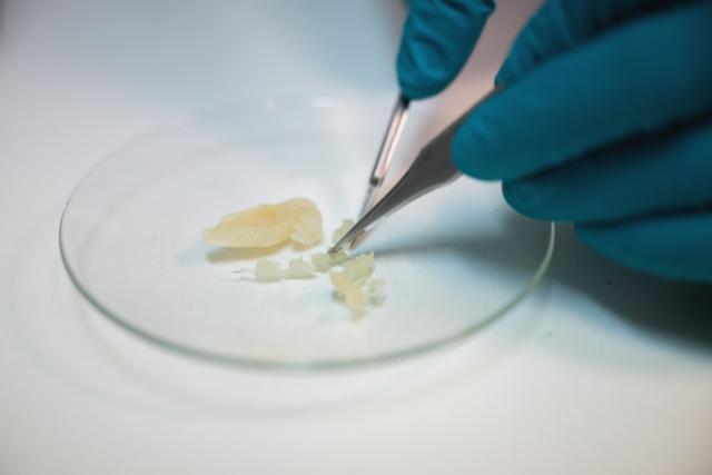 A marine biologist collects a tissue sample from a thawed silver-cheeked pufferfish (Lagocephalus sceleratus) for analysis at the Hellenic Centre for Marine Research (HCMR) in Heraklion, on the island of Crete, on June 2, 2026. Pufferfish, a warm-water invasive species, were first spotted in Greek waters some 20 years ago and are wreaking havoc with the country's fishing industry, a pillar of the nation's agricultural exports. The pufferfish explosion in Greek waters is the latest example of how warming oceans are changing ecosystems and upturning their reliant economies. (Photo by Angelos TZORTZINIS / AFP)