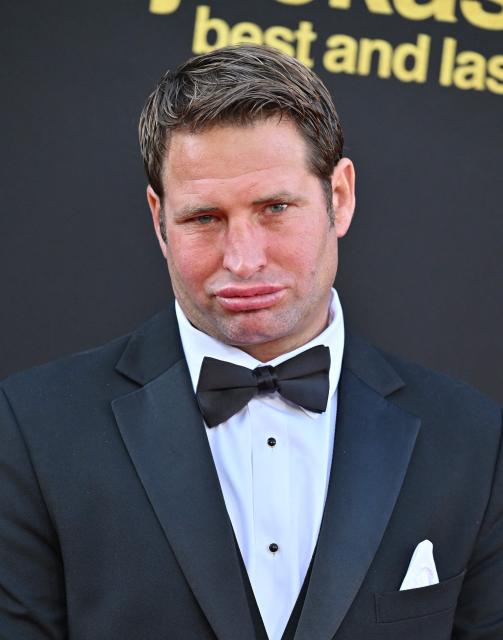 US surfer and stunt performer Sean McInerney aka Poopies attends the Los Angeles premiere of "Jackass: Best and Last" at the Paramount Theatre in Los Angeles on June 23, 2026. (Photo by LISA O'CONNOR / AFP)