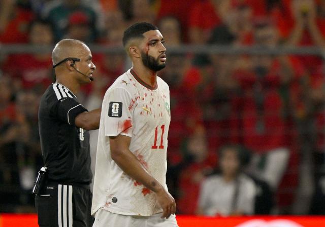 Brazilian referee Wilton Sampaio helps Morocco's midfielder #11 Ismael Saibari to leave the field bleeding during the 2026 World Cup round of 32 football match between the Netherlands and Morocco at the Monterrey Stadium in Guadalupe on June 29, 2026.  (Photo by Alfredo ESTRELLA / AFP)