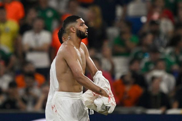 Morocco's midfielder #11 Ismael Saibari leaves the field bleeding during the 2026 World Cup round of 32 football match between the Netherlands and Morocco at the Monterrey Stadium in Guadalupe on June 29, 2026.  (Photo by Alfredo ESTRELLA / AFP)