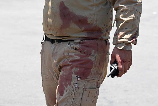 A security personnel with his clothes covered with blood stains, stands guard near the Four Seasons Hotel following two blasts nearby in Damascus on July 7, 2026. Two explosions shook Damascus on July 7 near a hotel where French President Emmanuel Macron was staying, wounding at least 18 people, during the French leader's landmark visit to Syria. (Photo by LOUAI BESHARA / AFP)