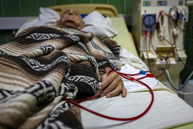 A patient with renal failure receives haemodialysis treatment at the Hermanos Ameijeiras Clinical Surgical Hospital in Havana, Cuba, on July 2, 2026. In the midst of one of the worst economic crises Cuba has experienced in decades, the health system is striving to maintain its services and priority programmes despite medicine and supply shortages, technological deterioration, staff shortages, prolonged power cuts and the impact of the United States sanctions. (Photo by YAMIL LAGE / AFP)