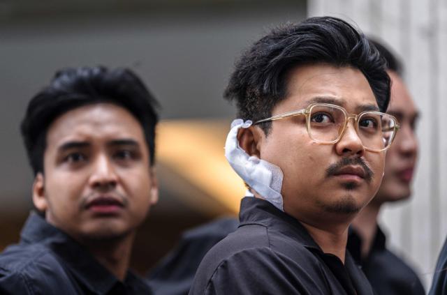 Athipat "Ice" Wijarn (R), whose band 'Tossakan' was performing when a fire broke out at the Rong Beer Na Lat Phrao bar, speaks to the media in Bangkok on July 13, 2026. A huge fire in a Bangkok bar killed at least 27 people and injured dozens, officials and witnesses said on July 13, the deadliest such incident in Thailand for almost two decades. (Photo by Chanakarn LAOSARAKHAM / AFP)