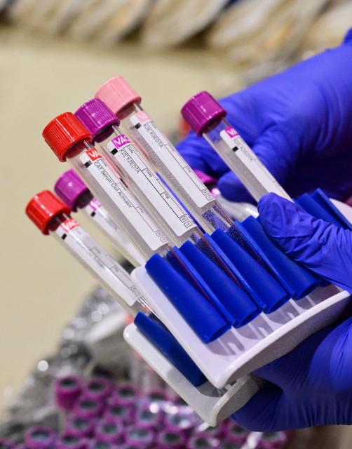 Vials are prepared for blood donations by an American Red Cross staff member during a blood drive amid an urgent need for donors at Providence St. Jude Medical Center in Fullerton, California, on August 4, 2026. The American Red Cross has declared its second-ever national blood supply crisis after donations fell to a four-year summer low, prompting a national emergency over declining blood supplies. (Photo by Frederic J. BROWN / AFP)
