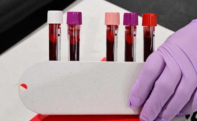 Vials containing donated blood is handled by an American Red Cross staff member during a blood drive amid an urgent need for donors at Providence St. Jude Medical Center in Fullerton, California, on August 4, 2026. The American Red Cross has declared its second-ever national blood supply crisis after donations fell to a four-year summer low, prompting a national emergency over declining blood supplies. (Photo by Frederic J. BROWN / AFP)