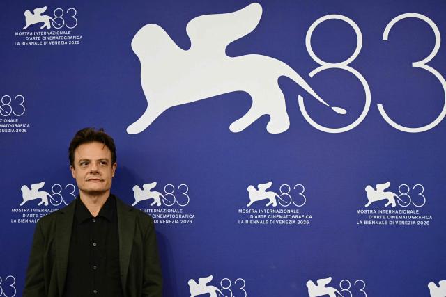 Italian actor Lino Musella attends the photocall of "Il fuoco che ti porti dentro" (The Fire within you) presented in competition at the 83rd International Venice Film Festival, at Venice Lido on September 9, 2026. (Photo by Stefano Rellandini / AFP)