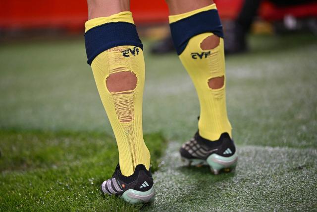 The socks of Villarreal's Spanish striker #07 Gerard Moreno are pictured during the UEFA Champions League football match between Liverpool and Villareal at Anfield in Liverpool, north west England on October 20, 2026. (Photo by Paul ELLIS / AFP)