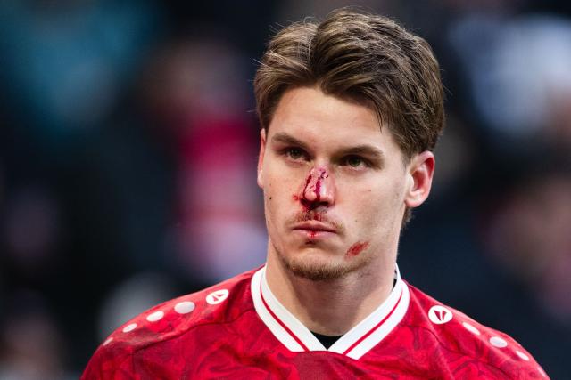 25 January 2026, North Rhine-Westphalia, Moenchengladbach: Stuttgart's Ramon Hendriks is bleeding from the nose during the German Bundesliga soccer match between Borussia Moenchengladbach and VfB Stuttgart at Borussia-Park Stadium. Photo: Marius Becker/dpa - WICHTIGER HINWEIS: Gemäß den Vorgaben der DFL Deutsche Fußball Liga bzw. des DFB Deutscher Fußball-Bund ist es untersagt, in dem Stadion und/oder vom Spiel angefertigte Fotoaufnahmen in Form von Sequenzbildern und/oder videoähnlichen Fotostrecken zu verwerten bzw. verwerten zu lassen.