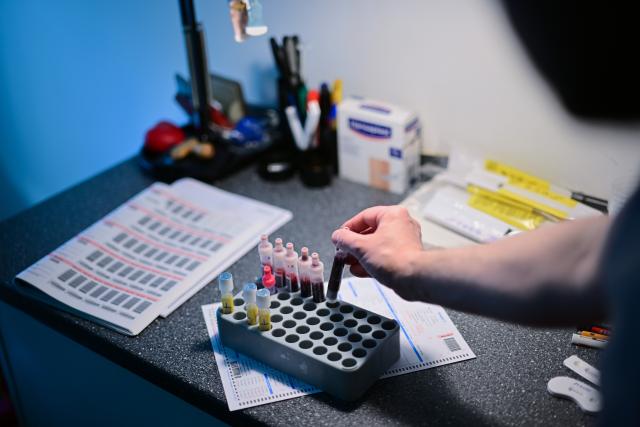 FILED - 29 April 2025, Berlin: FILED PHOTO - A doctor places a blood ampoule for a test for HIV and other sexually transmitted diseases in a carrier at the Berlin AIDS service organization. Photo: Sebastian Gollnow/dpa