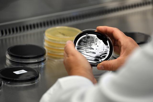 08 November 2016, Nordrhein-Westfalen, Düsseldorf: FILE PHOTO - A staff member holds a Petri dish containing Legionella samples in a specialized laboratory in Duesseldorf. Photo: Federico Gambarini/dpa/dpa-tmn
