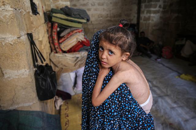 (250512) -- GAZA CITY, May 12, 2025 (Xinhua) -- A Palestinian mother and her 6-year-old daughter, who is suffering from malnutrition, are seen at a temporary shelter in east of Gaza City, on May 11, 2025.
  Palestinian and UN officials warned Sunday that the health and humanitarian situation in Gaza will further deteriorate if Israel continues its blockade on the enclave. (Photo by Rizek Abdeljawad/Xinhua)