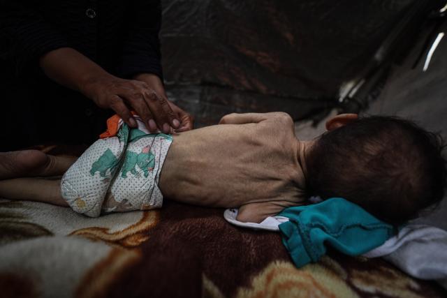 (250529) -- GAZA, May 29, 2025 (Xinhua) -- This photo taken on May 28, 2025 shows a child suffering from severe malnutrition at a camp for displaced people, west of Gaza City. (Photo by Mahmoud Zaki/Xinhua)