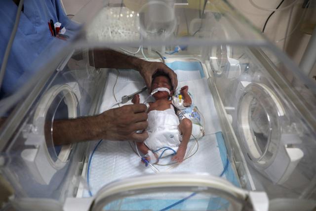 (250703) -- GAZA, July 3, 2025 (Xinhua) -- A Palestinian premature baby receives medical care at Al-Aqsa Martyrs Hospital, in Deir al-Balah city, the central Gaza Strip, on July 2, 2025. (Photo by Rizek Abdeljawad/Xinhua)