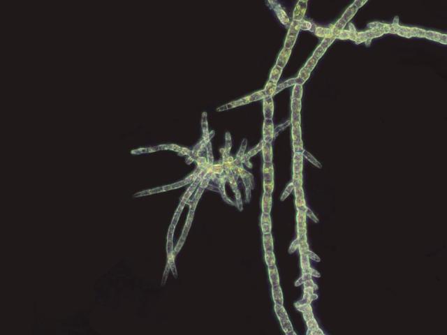 (250706) -- CANBERRA, July 6, 2025 (Xinhua) -- This image taken on July 4, 2025 shows a native freshwater filamentous algal population. TO GO WITH "Researchers use algae to recycle wastewater in drought-stricken regions" (Flinders University/Handout via Xinhua)