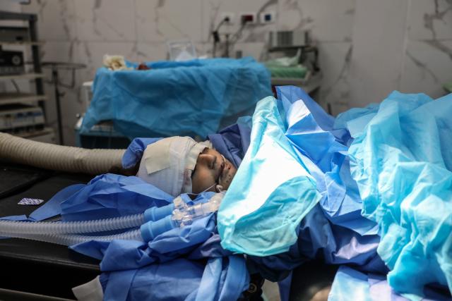 (251027) -- GAZA, Oct. 27, 2025 (Xinhua) -- A Palestinian injured child is seen at Al-Shifa Hospital in Gaza City, on Oct. 24, 2025. According to data from the United Nations Mine Action Service (UNMAS), at least 320 Palestinians have been killed and injured by unexploded ordnance across the Gaza Strip since the start of the conflict in October 2023.
   TO GO WITH "Feature: Unexploded ordnance in Gaza poses deadly threat to residents despite ceasefire" (Photo by Rizek Abdeljawad/Xinhua)