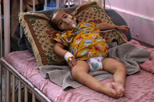 (251201) -- KHAN YOUNIS, Dec. 1, 2025 (Xinhua) -- A Palestinian child receives treatment at Nasser Medical Complex in Khan Younis, southern Gaza Strip, on Dec. 1, 2025, while awaiting Israeli permission to travel abroad for critical medical care. (Photo by Rizek Abdeljawad/Xinhua)