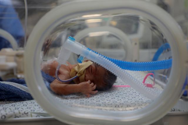 (251202) -- BEIJING, Dec. 2, 2025 (Xinhua) -- An infant receives treatment at Nasser Medical Complex in Khan Younis, southern Gaza Strip, on Dec. 1, 2025, while awaiting Israeli permission to travel abroad for critical medical care. (Photo by Rizek Abdeljawad/Xinhua)