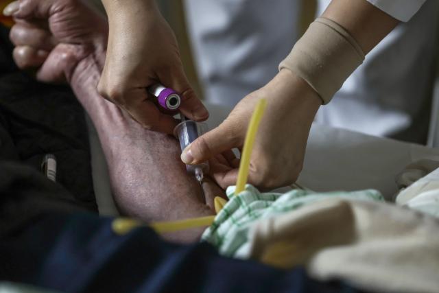 (260214) -- BEIJING, Feb. 14, 2026 (Xinhua) -- At 5:20 a.m. on Feb. 4, 2026: a nurse draws blood from a patient in a ward in the Emergency Department of Guang'anmen Hospital in Beijing, capital of China. With the Spring Festival just around the corner, the staff members at the Emergency Department of Guang'anmen Hospital remain on duty around the clock. Racing against time, they are fully committed to protect the health of patients.
   As a national-level emergency center which integrates Traditional Chinese Medicine and Western medicine, the Emergency Department of Guang'anmen Hospital was founded over 40 years ago. Generations of medical practitioners have carried forward the wisdom of Traditional Chinese Medicine while keeping pace with modern emergency rescue. They are not only proficient in using advanced emergency equipment such as Extracorporeal Membrane Oxygenation (ECMO) and ultrasound diagnostic instruments to rescue critically ill patients, but also provide patients with precise and effective characteristic diagnosis and treatment, featuring over 30 hospital-agreed prescriptions and more than 20 external treatment methods of Traditional Chinese Medicine. (Xinhua/Zhang Yuwei)