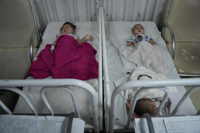 (260713) -- KABUL, July 13, 2026 (Xinhua) -- Malnourished children are pictured at the Indira Gandhi Institute of Child Health in Kabul, Afghanistan, July 13, 2026. The UN Children's Fund (UNICEF) has raised the alarm that 3.7 million children under the age of 5 in Afghanistan are at heightened risk of malnutrition, according to a new report issued on Sunday. (Photo by Saifurahman Safi/Xinhua)