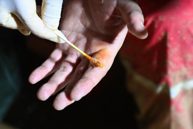 (260714) -- NANNING, July 14, 2026 (Xinhua) -- A medical worker disinfects a hand of a rescuer in a village in Hengzhou City, south China's Guangxi Zhuang Autonomous Region, July 7, 2026. Efforts are underway to support flood relief and recovery in Guangxi, which has been hit by severe rainstorms and flooding caused by Typhoon Maysak. (Xinhua/Cao Yiming)