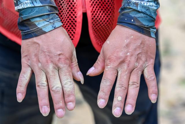 (260714) -- NANNING, July 14, 2026 (Xinhua) -- This photo taken on July 14, 2026 shows the hands of a volunteer in Yunbiao Town, Hengzhou City, south China's Guangxi Zhuang Autonomous Region. Efforts are underway to support flood relief and recovery in Guangxi, which has been hit by severe rainstorms and flooding caused by Typhoon Maysak. (Xinhua/Cao Yiming)