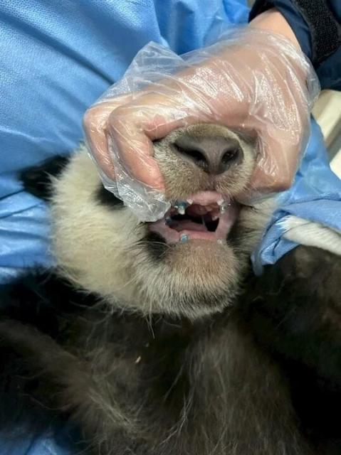 (260919) -- CHENGDU, Sept. 19, 2026 (Xinhua) -- Giant panda Beixia receives orthopedic treatment at the West China Hospital of Stomatology of Sichuan University in Chengdu, southwest China's Sichuan Province in January 2026. TO GO WITH "First-ever orthodontic treatment restores giant panda's normal bite in China" (Xinhua)