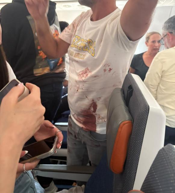(260930) -- TEL AVIV, Sept. 30, 2026 (Xinhua) -- This photo released by an Israeli media agency shows a passenger with bloodstains on his clothes aboard a Flydubai commercial flight from Dubai to Tel Aviv, on Sept. 30, 2026. Israeli security agencies were investigating an incident aboard a Flydubai flight from Dubai to Tel Aviv after the aircraft transmitted an emergency signal and descended sharply before diverting to Saudi Arabia on Wednesday. (Xinhua)